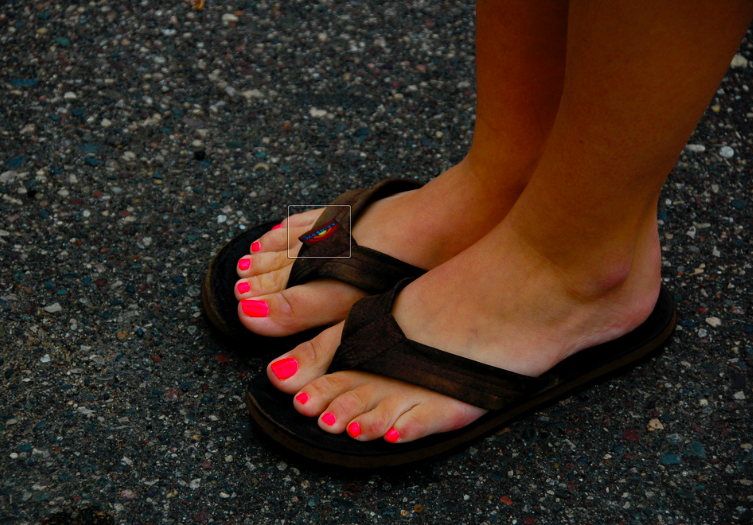 Summertime Footwear: The Dangers of Wearing Flip Flops